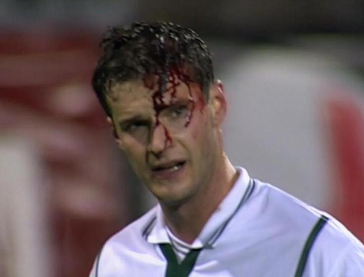 Tik pred koncem prvega polčasa dvoboja med Slovenijo in Rusijo je prejel močan udarec s komolcem v glavo. | Foto: Osebni arhiv