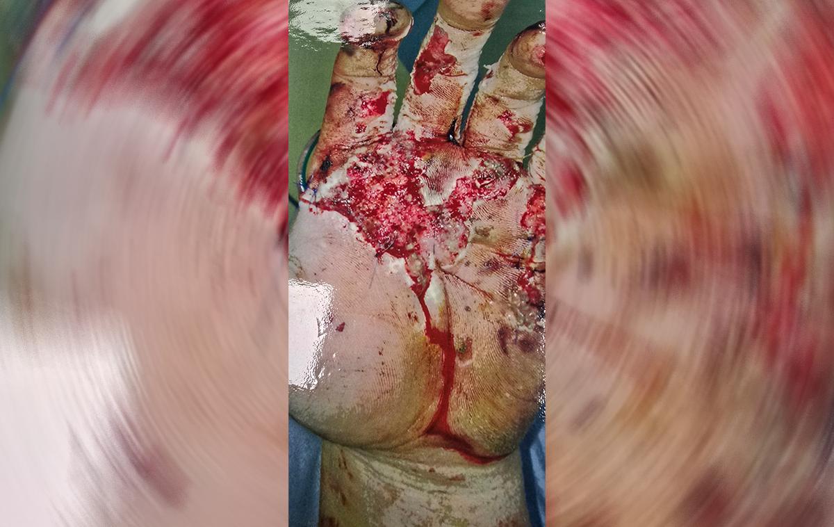 Petarde. | Policisti znova opozarjajo vse, ki se ne morejo upreti uporabi pirotehničnih sredstev, naj jih nikar ne kupujejo od preprodajalcev na tržnicah, bolšjih sejmih ali drugje na ulicah, prav tako naj ne kupujejo izdelkov, ki jih posamezniki prodajajo na družbenih omrežjih, saj predstavljajo resno nevarnost za poškodbe.  | Foto Policija