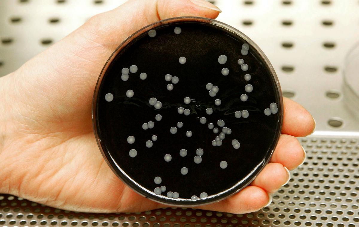 legionarska bolezen legionela kolonije voda | Legionelozo povzroča bakterija legionela.  | Foto Reuters