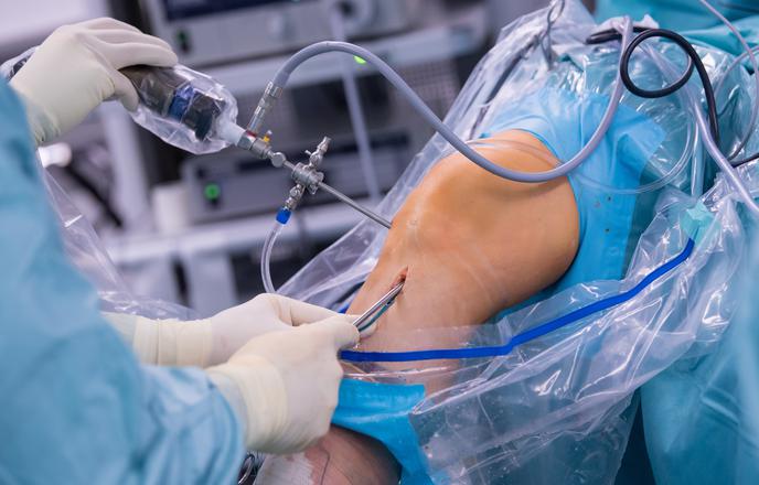 Zapis o čakalni dobi do 2027? Podatki kažejo povsem drugačno sliko.