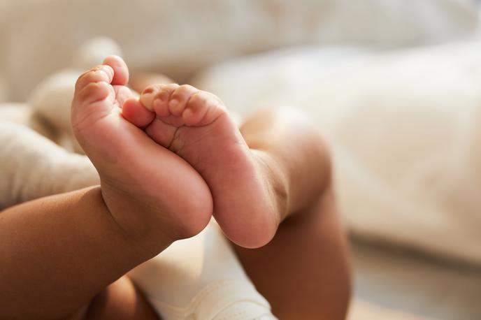 Novorojenček | Enojajčni dvojčici so ločili ob rojstvu. | Foto Getty Images