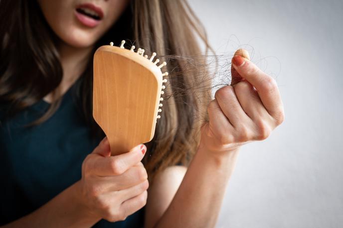 izpadanje las | Foto Shutterstock