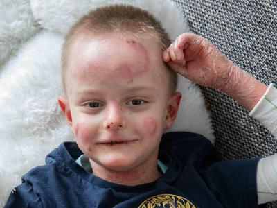 Dobra novica za malega Miloša: gensko zdravljenje bo prejemal tudi v Sloveniji