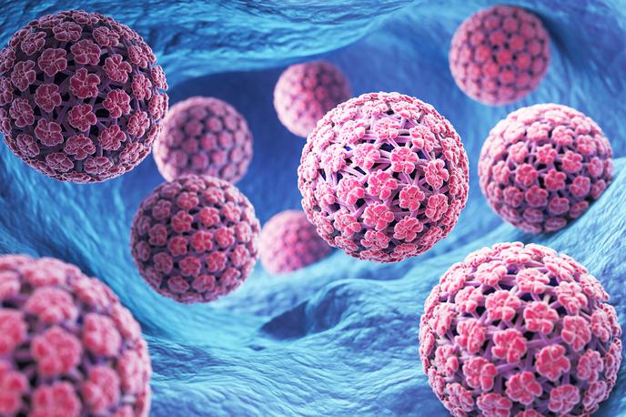 HPV | Večina ljudi je že bila okužena z virusom HPV, najpogosteje povsem neopaženo, a ta zahrbtni virus lahko povzroči resne posledice, tudi rakasta obolenja. | Foto Shutterstock