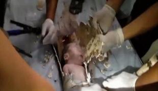 Na Kitajskem iz kanalizacije rešili živega dojenčka