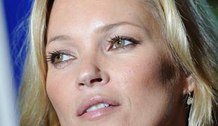 Trend med manekenkami: tudi Kate Moss poje