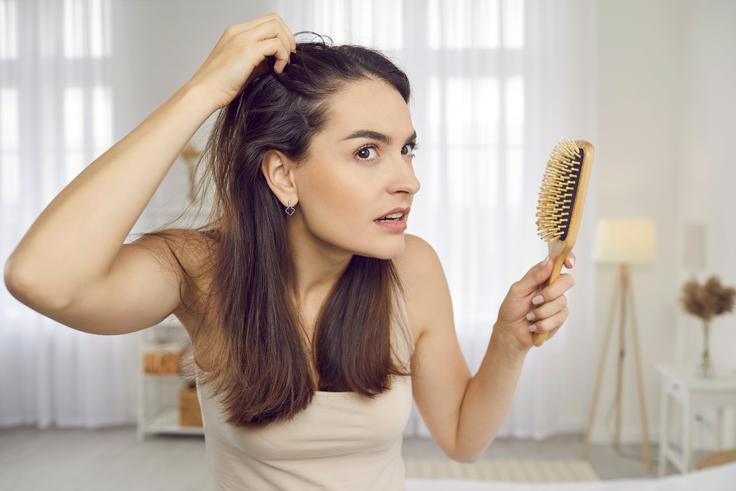 izpadanje las | Foto: Shutterstock