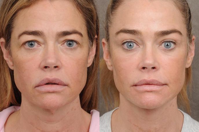 Denise Richards | Foto Instagram