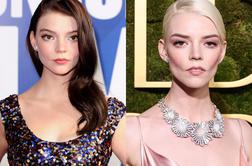 Estetski kirurg opozarja: Številni bodo ta lepotni poseg obžalovali