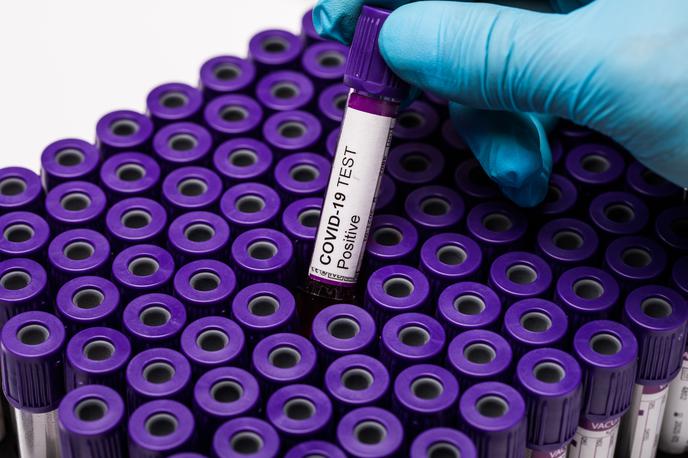 Covid. Koronavirus. Testiranje. Korona. Covid-19 | V primerjavi s podatki pred tednom dni številke še naprej padajo.  | Foto Shutterstock