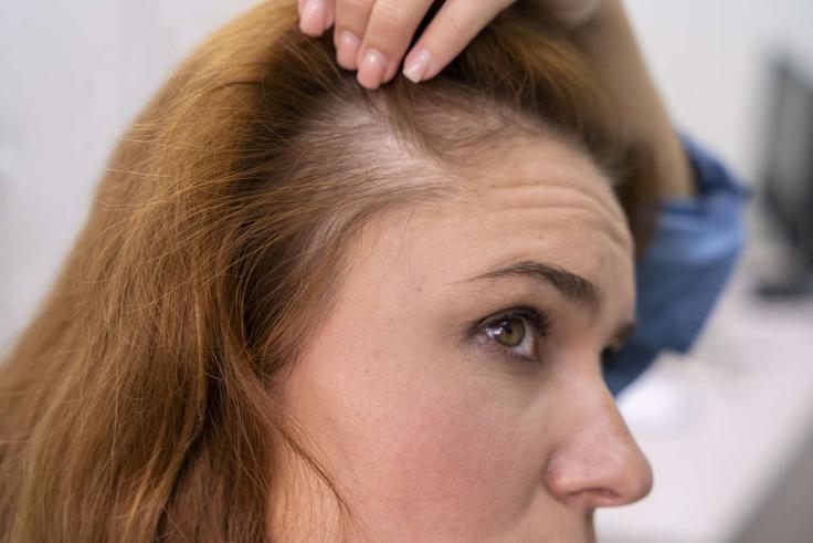 woman-getting-hair-loss-treatment-clinic_1200 | Foto: Freepik.com / Mind trade d.o.o.