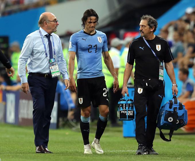 Poškodba zvezdnika urugvajske reprezentamce Edinsona Cavanija ni tako huda, kot je kazalo.  | Foto: Getty Images