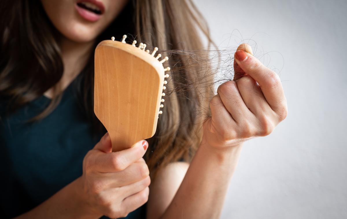 izpadanje las | Foto Shutterstock