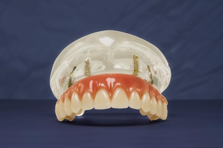 Ortoimplant, SMT dent | Foto: ORTOIMPLANT DENTAL SPA