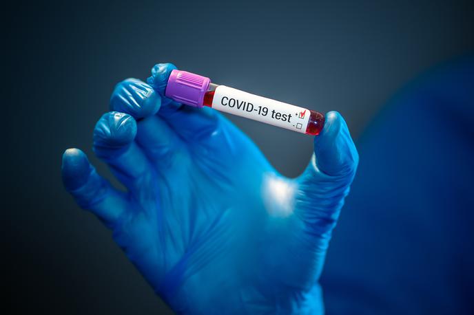 Koronavirus | Foto Getty Images
