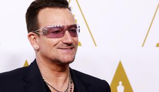 Nesrečni Bono si je poškodoval tudi obraz