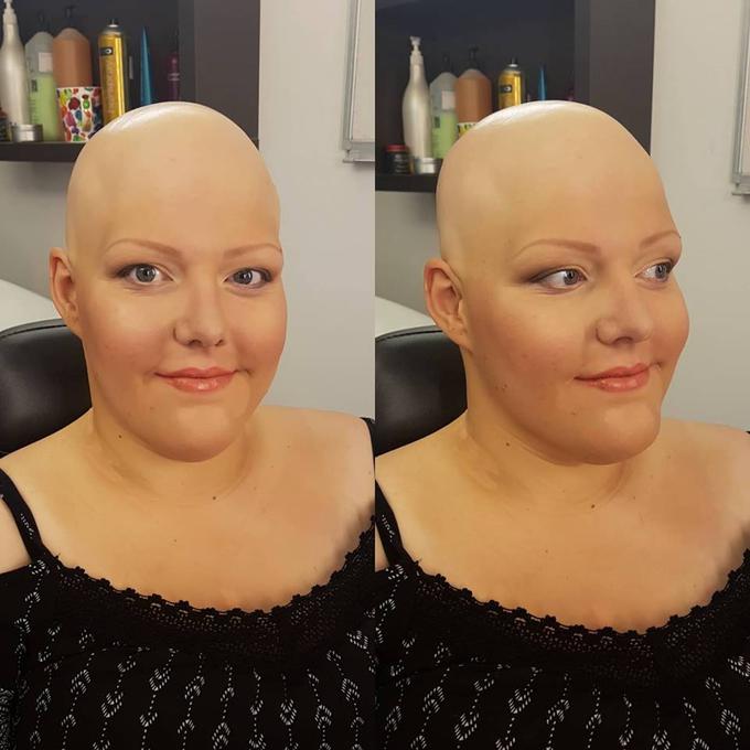 Katja že dolga leta živi z alopecijo in s svojim pozitivnim odnosom daje zgled mnogim. Na fotografiji ji je vizažistka Sarah Bamburač za snemanje oddaje Od težaka do junaka poleg klasičnega mejkapa zarisala tudi obrvi. | Foto: Sarah Bamburač