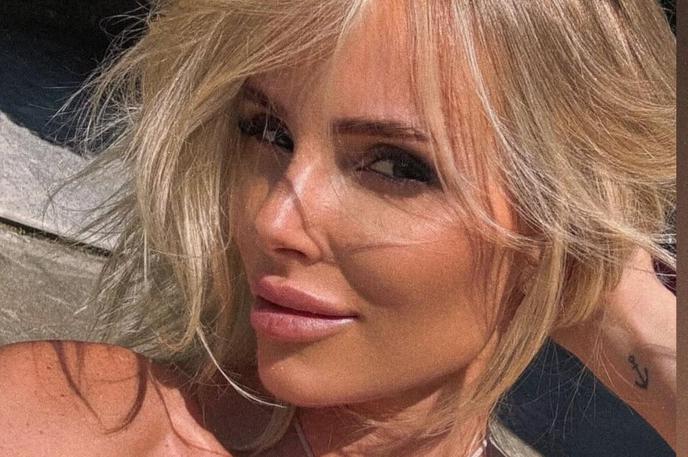 Tadeja Plestenjak (Majerič) | Tadeja Plestenjak prisega na uporabo regenerativnega tretmaja microneedlinga z avtolognimi eksosomi. | Foto Instagram/tadeja.majeric