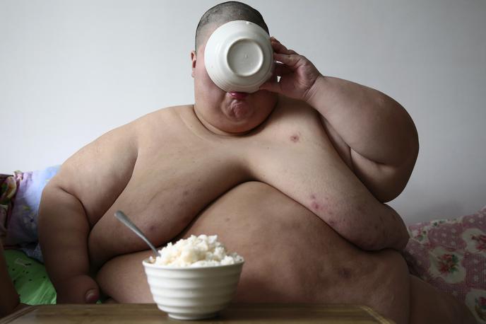 Debelost, prevelika teža | Foto Reuters