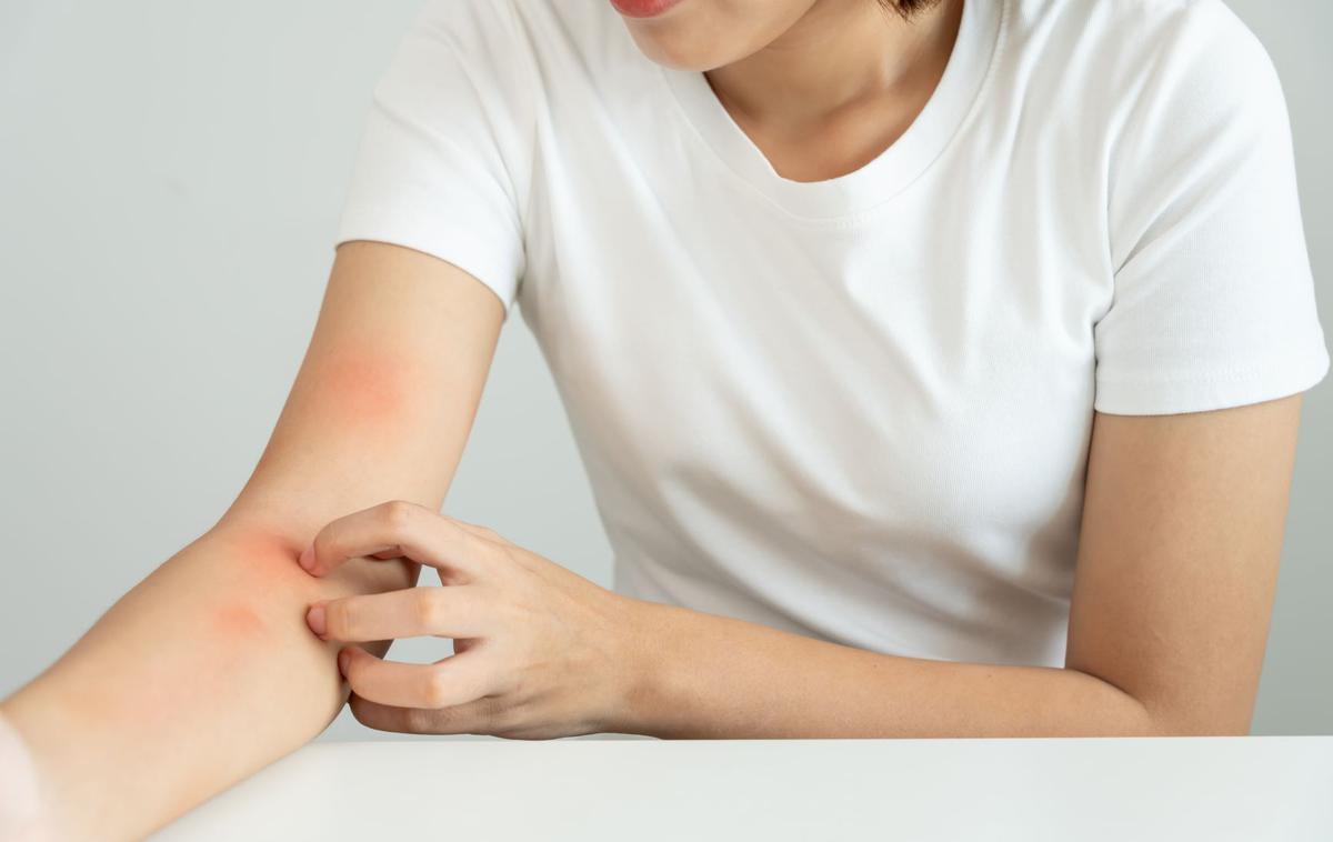 Medicofit, lupus | Foto Medicofit