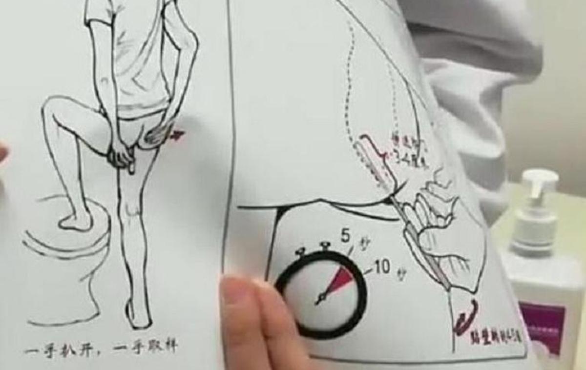 analni test | Kitajske oblasti so med stanovalci bloka, kjer so zasledili prvi primer okužbe z omikronom, odredili analno testiranje na covid-19.  | Foto zajem zaslona