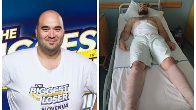 Aleš Hrvatin prestal operacijo odstranitve odvečne kože #foto