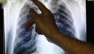 Balkanski boj s tuberkulozo