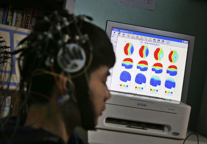 Oprijemljivih znanstvenih dokazov, da zdravljenje z elektrošoki res deluje in je varno, namreč ni.  | Foto: Reuters