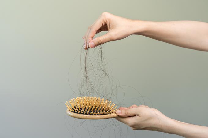 Preprečite poškodbe las s pravilnim negovanjem. | Foto: Shutterstock