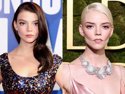 Estetski kirurg: Številni bodo sčasoma obžalovali odločitev za ta poseg