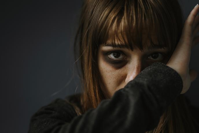 Mati umrla zaradi poškodb brutalnega napada