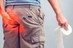 Niste edini! Hemoroidi niso tabu in rešitev obstaja.