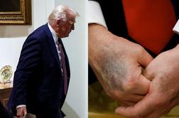 Kje je Donald Trump? Širijo se divje govorice.