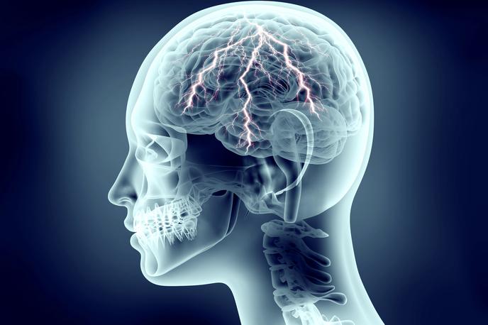 Možgani. | Foto Thinkstock