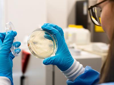 Zdravniki svarijo pred glivično okužbo: odporna je na zdravila in hitro se širi