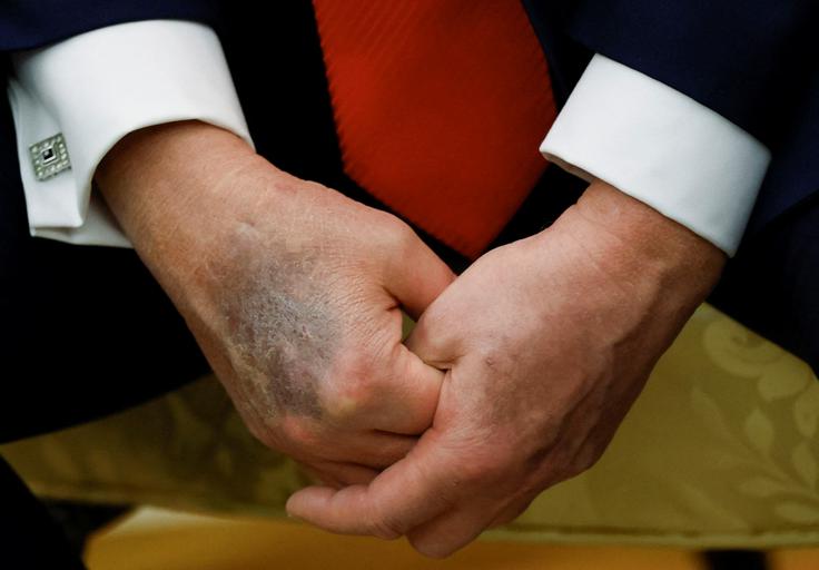 Roke Donalda Trumpa, 25. avgust 2025 | Foto: Reuters