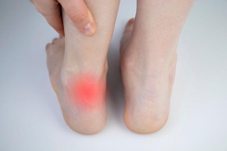 ahilova tetiva | Foto: Shutterstock/Medicofit