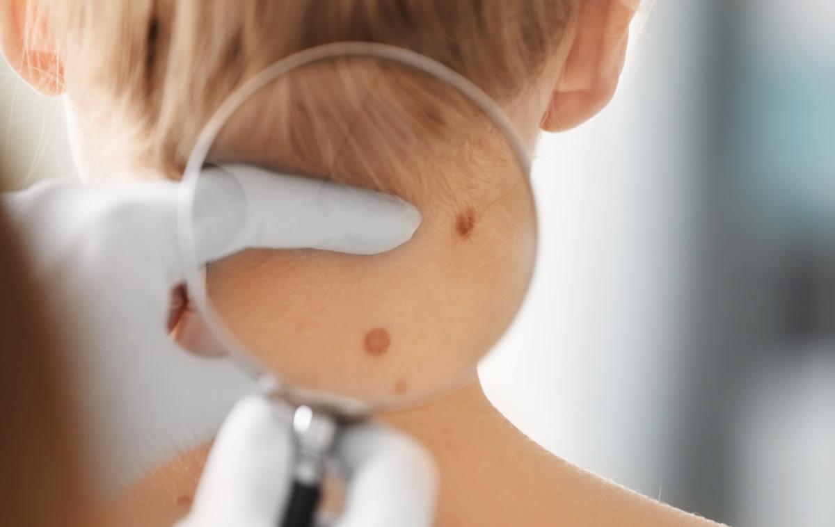 dermatolog | Foto Shutterstock