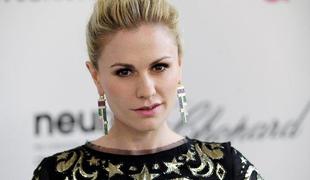 Anna Paquin: Lepotne operacije bi me omejevale