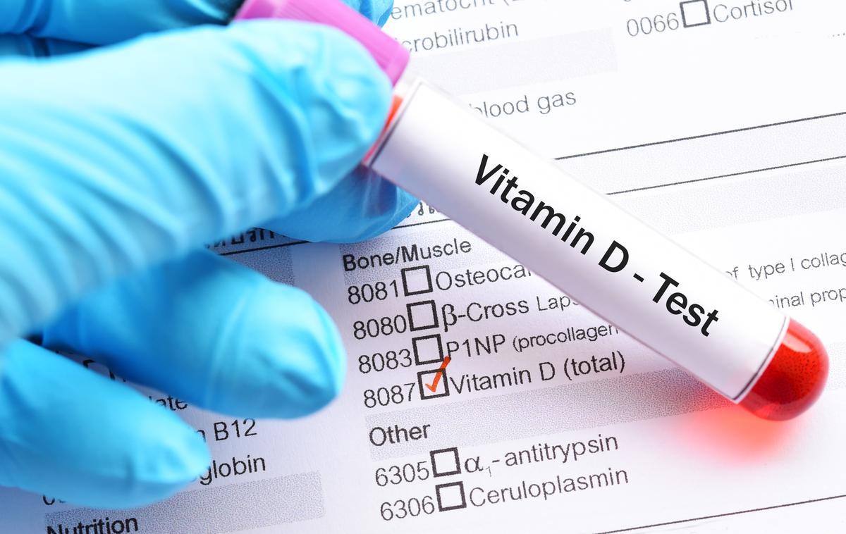 Vitamin D | Vitamin D je pomemben za zdrave kosti in močan imunski sistem. | Foto Getty Images