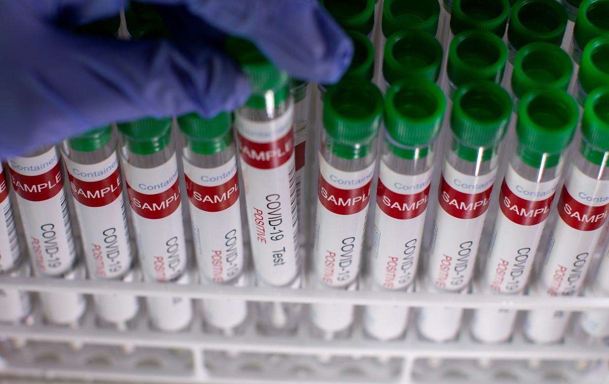 covid | Število novih okužb s koronavirusom je spet visoko.  | Foto Reuters