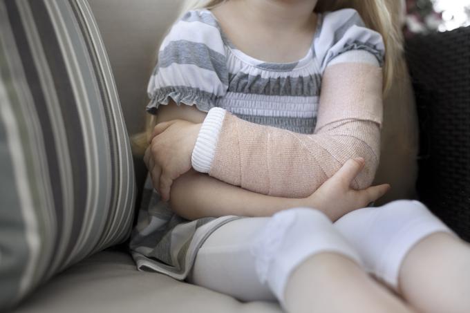 zlomljena roka zlom | Foto: Getty Images