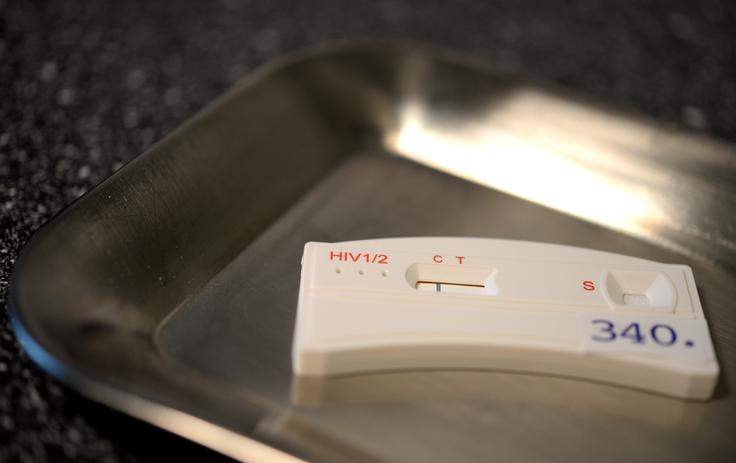 Hitri test na HIV lahko naredite tudi sami.  | Foto: Guliverimage
