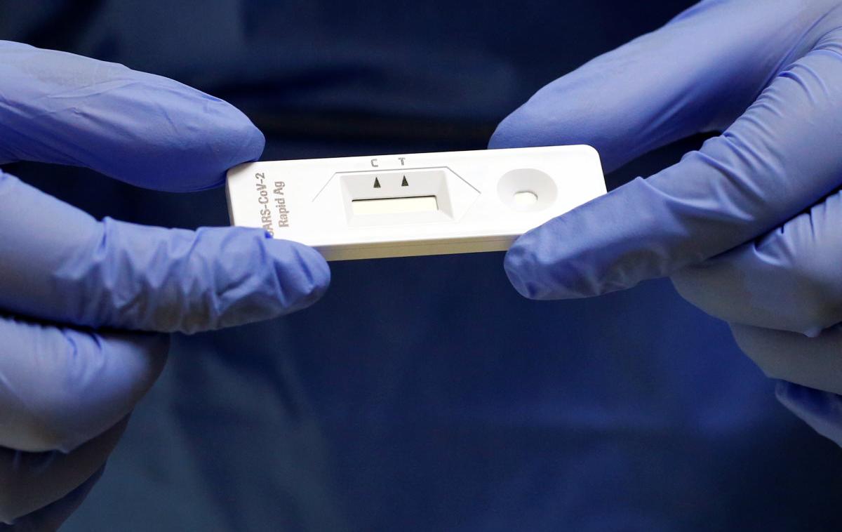Hitri test, Antigenski test | Geneplanet bo v dveh mesecih v UKC Ljubljana dobavil največ deset tisoč hitrih antigenskih testov. | Foto Reuters