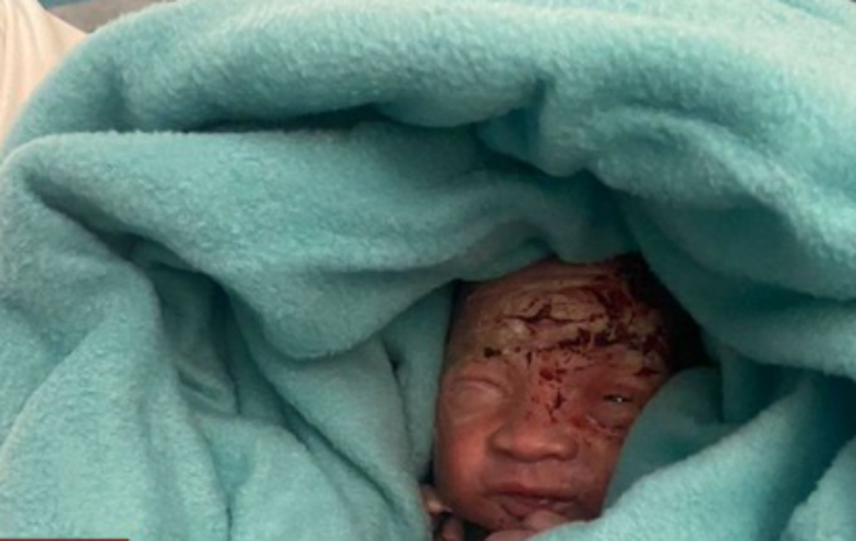 Dojenček | Novorojenčka je osebje našlo v košu za smeti.  | Foto Twitter