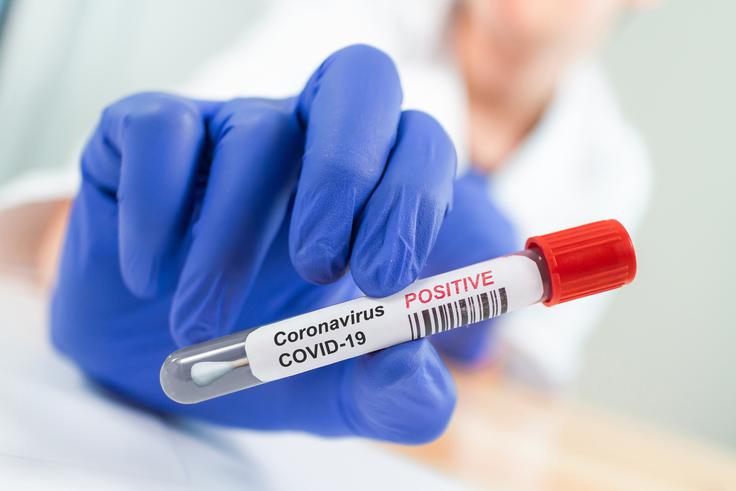 Koronavirus. | Foto: Getty Images