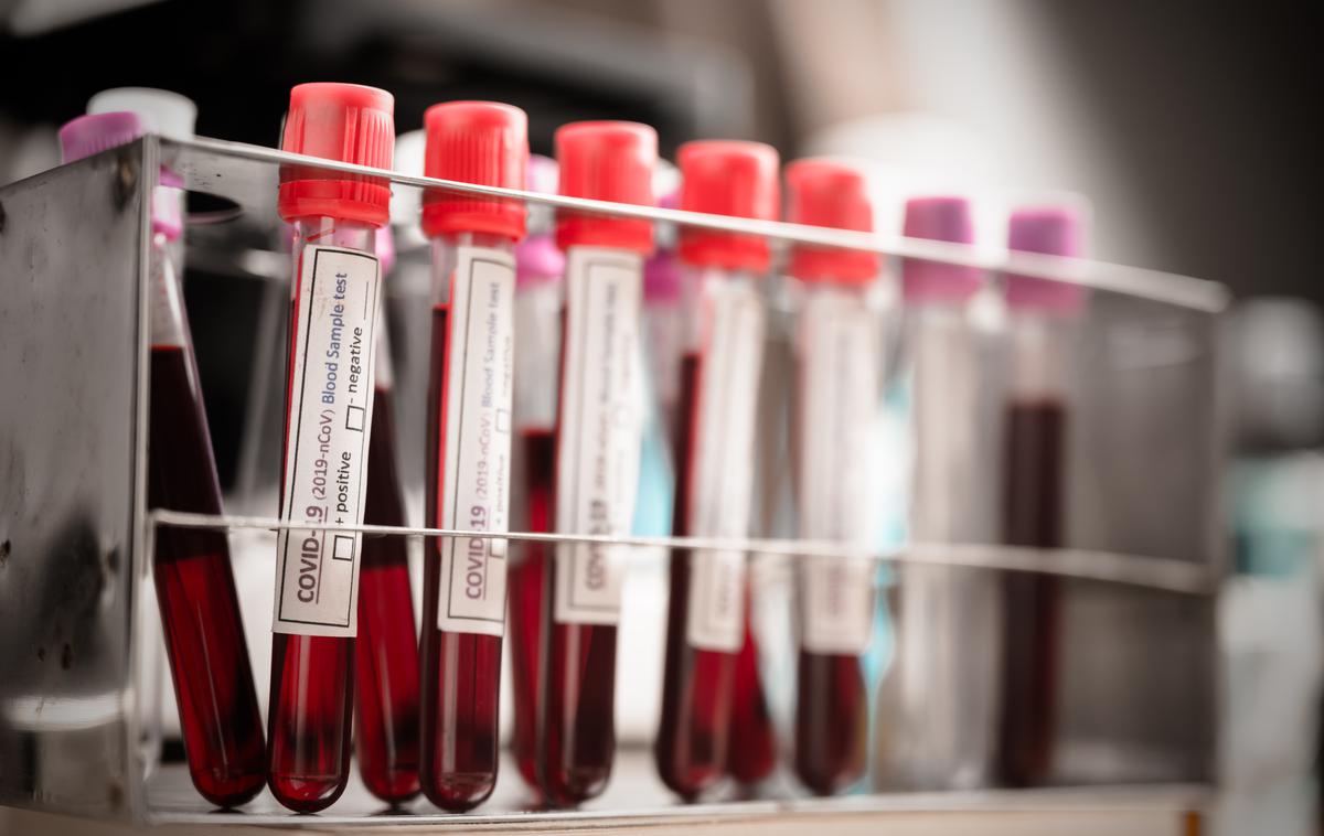 Covid. Koronavirus. Testiranje. Korona. Covid-19 | Število okuženih je bilo v primerjavi s prejšnjo nedeljo včeraj spet višje. | Foto Shutterstock