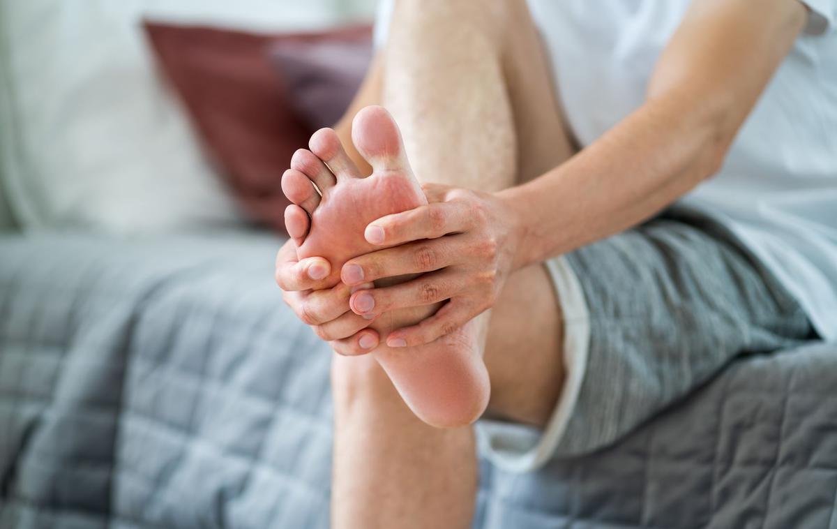 Medicofit, Mortonov nevrom | Foto Medicofit