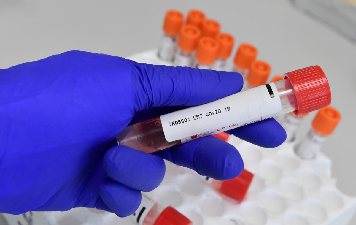 covid-19 | Včeraj so potrdili 477 okužb s koronavirusom. | Foto Reuters