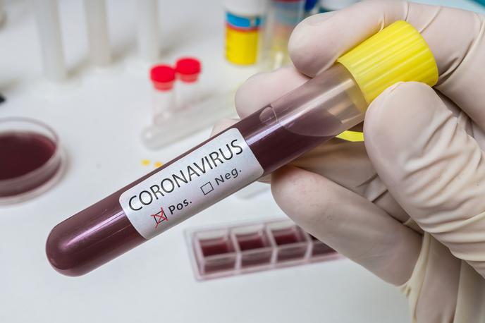 Koronavirus | Kljub večkratnim opozorilom ljudje še vedno ne upoštevajo navodil, kako ravnati v primeru suma na okužbo z novim koronavirusom. | Foto Getty Images